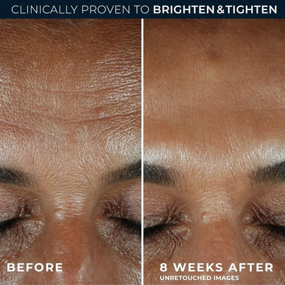 RoC Multi Correxion Revive + Glow Daily Serum + Vitamin C (1.0+1.7 fl oz)