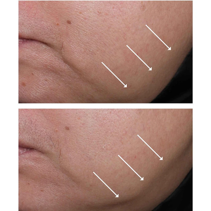 StriVectin Contour Restore Tightening & Sculpting Face Cream - 1 oz*2 Pack
